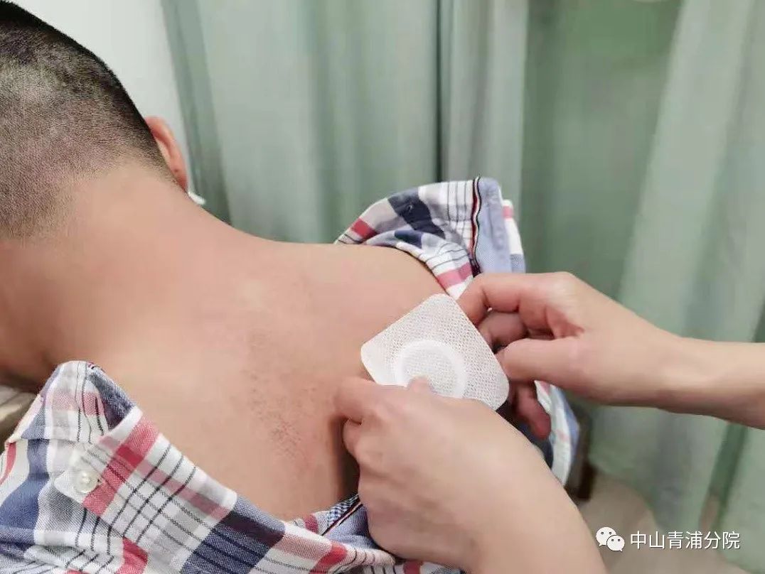 2、江西兒童貼三伏貼癢灼痛，什么體質(zhì)的人可以貼三伏貼癢灼痛？